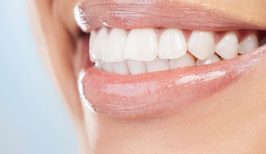 Manningtree Dental - Full Arch Implants