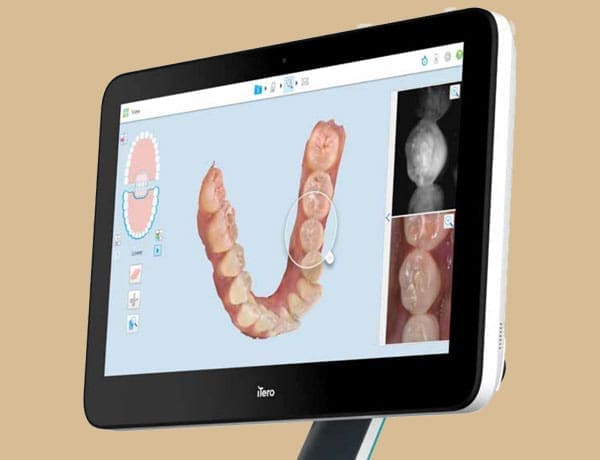 Digital intra oral Scanner - Manningtree Dental