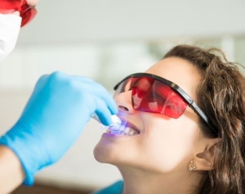 Stained Teeth Still Need More Than Just A Polish