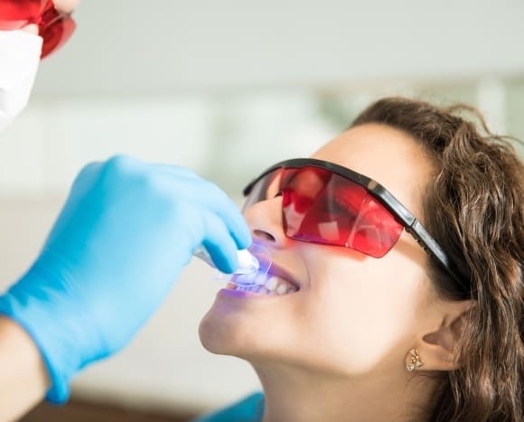 Stained Teeth Still Need More Than Just A Polish