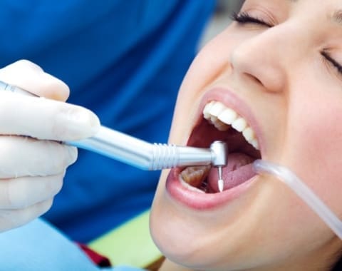 dermal fillers